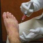 injection into foot